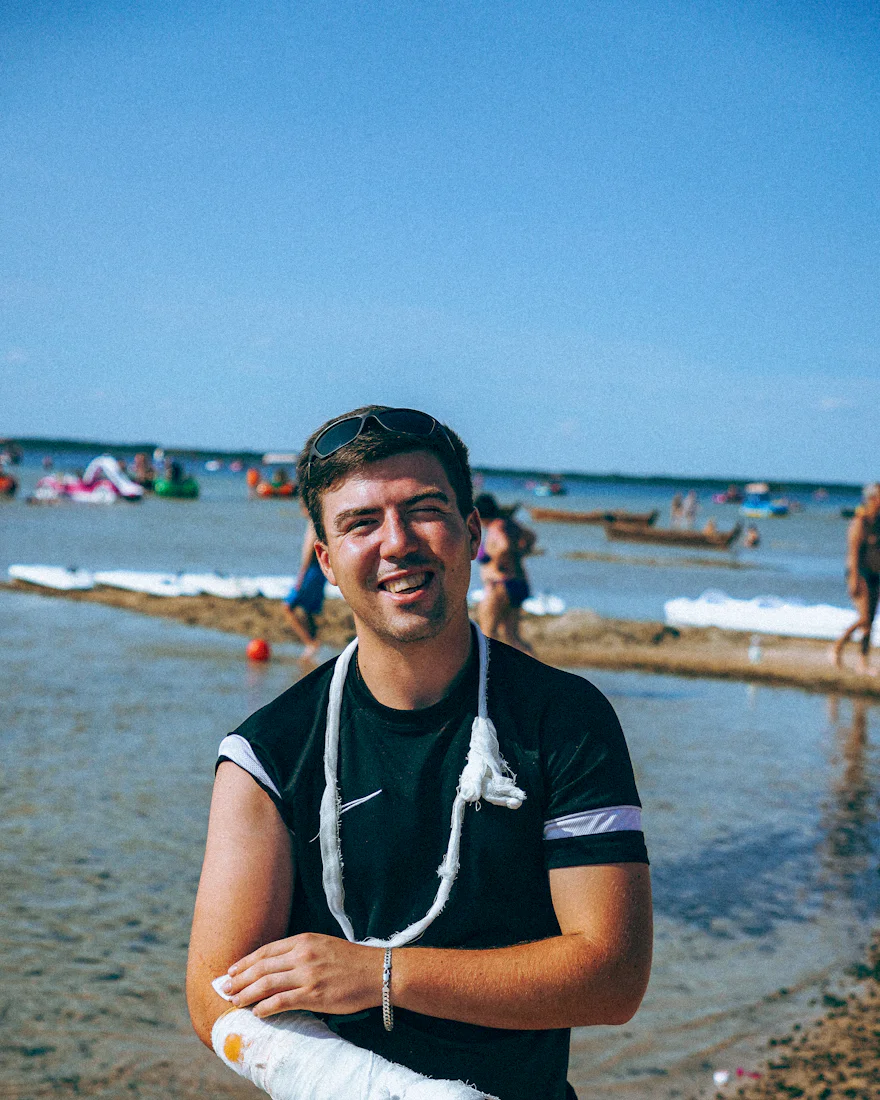 Lachende man op het strand met zijn arm in het gips